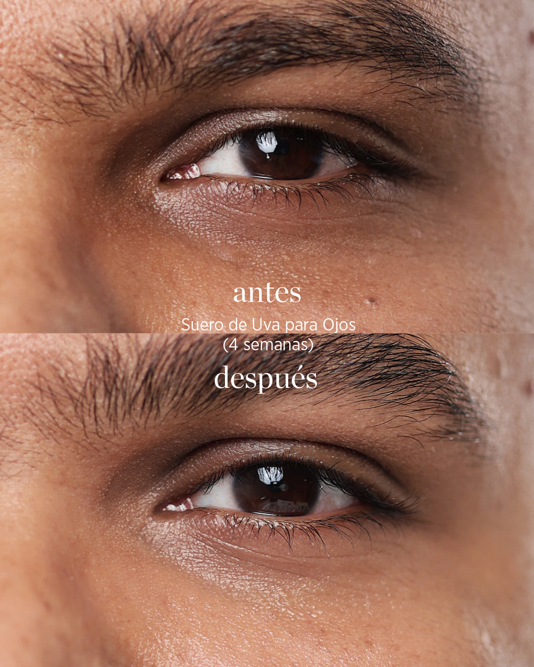 Suero de uva para ojos Ere Perez diferencia antes y despues en ojo masculino en BLUMMA