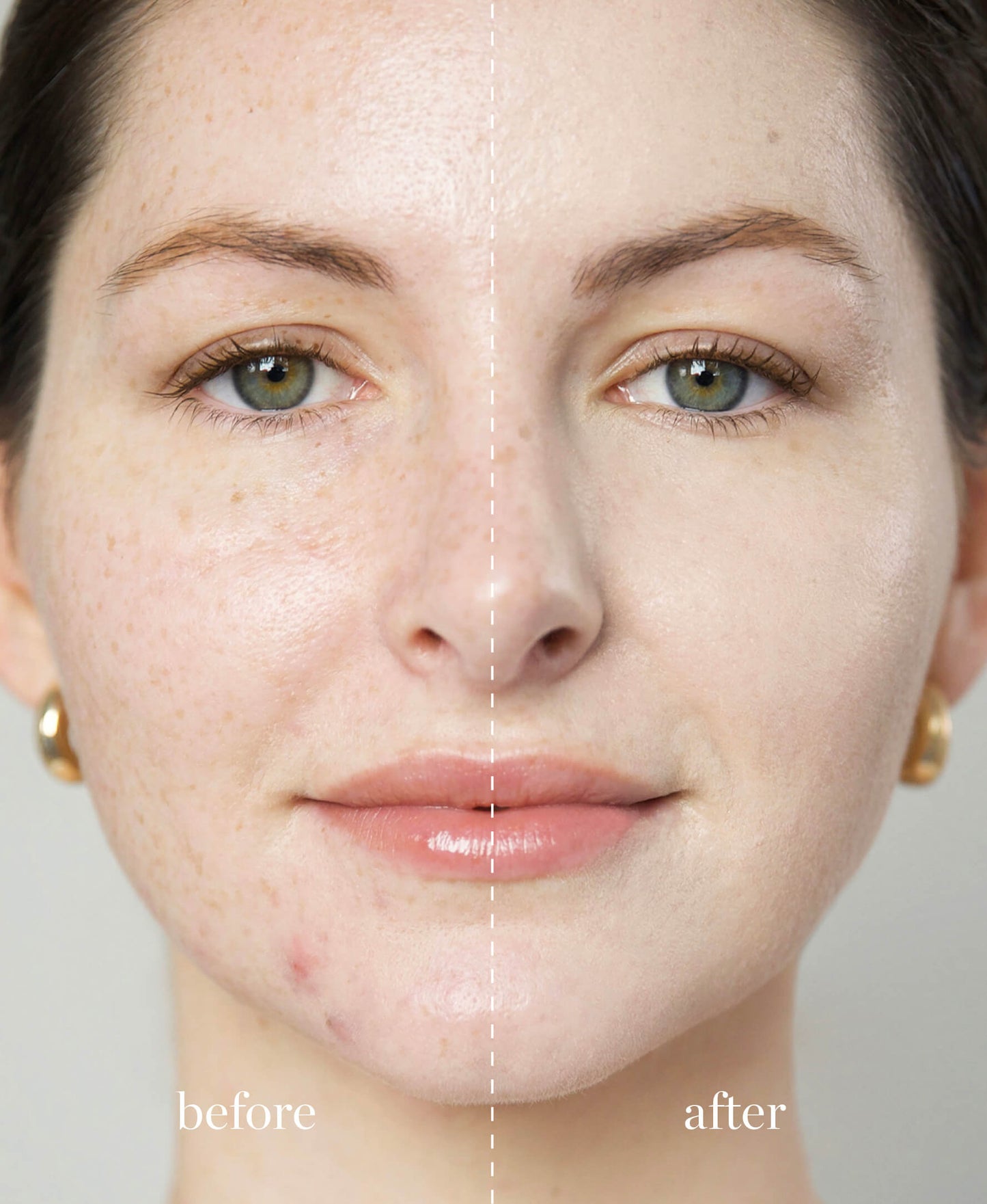 imagen de una mujer viendo hacia la camara mostrando el antes y después de usar la base corrector de arnica ere perez en tono latte disponible en blumma