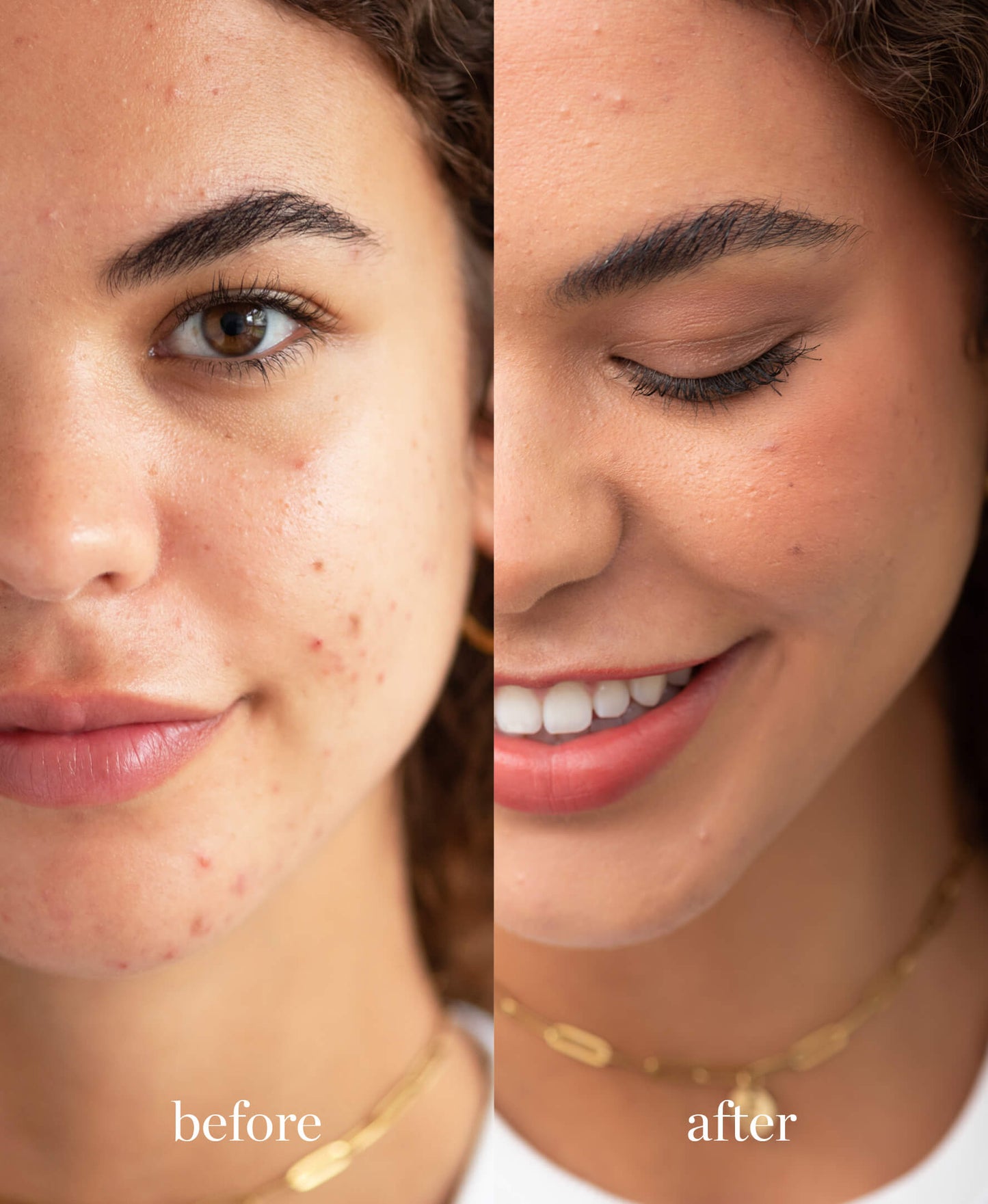 imagen de mujer viendo a la camara mostrando el antes y el despues de usar la base corrector de arnica en tono brew ere perez disponible en blumma