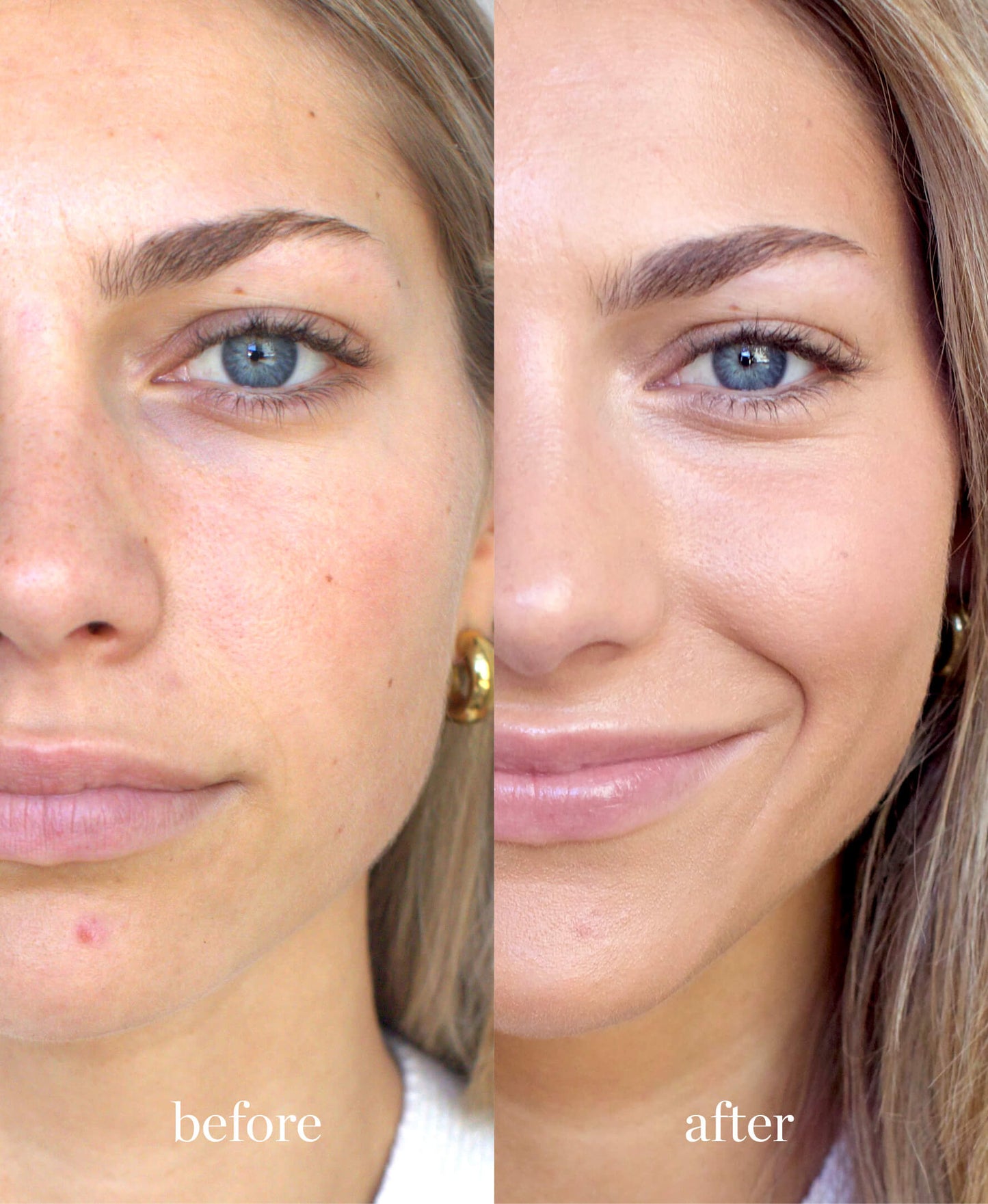 imagen de mujer viendo a la camara mostrando el antes y el despues de usar la base corrector de arnica en tono chai ere perez disponible en blumma