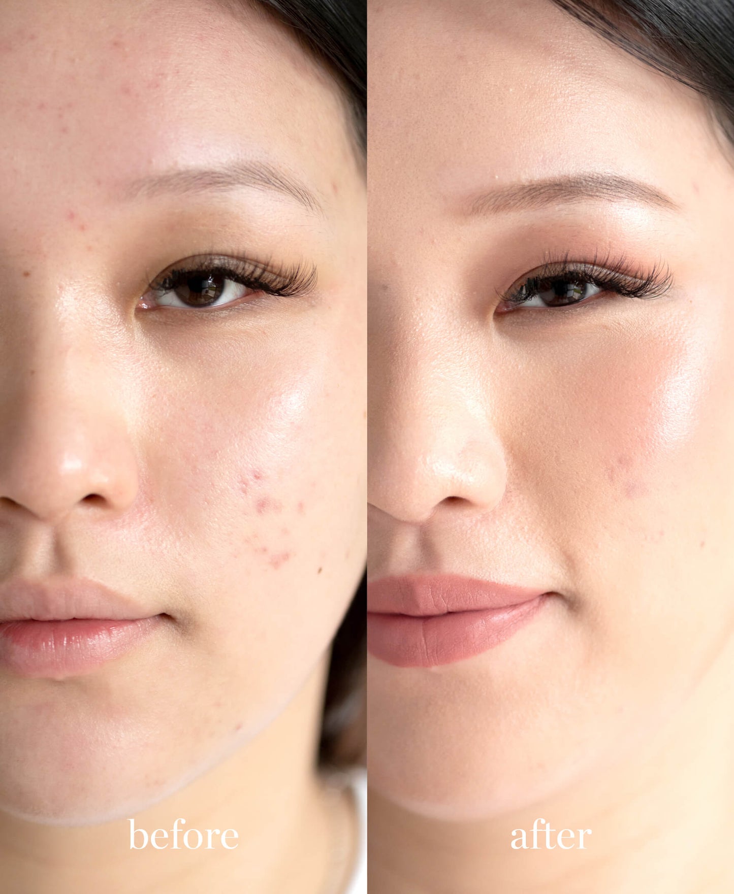 imagen de mujer viendo a la camara mostrando el antes y el despues de usar la base corrector de arnica en tono honey ere perez disponible en blumma