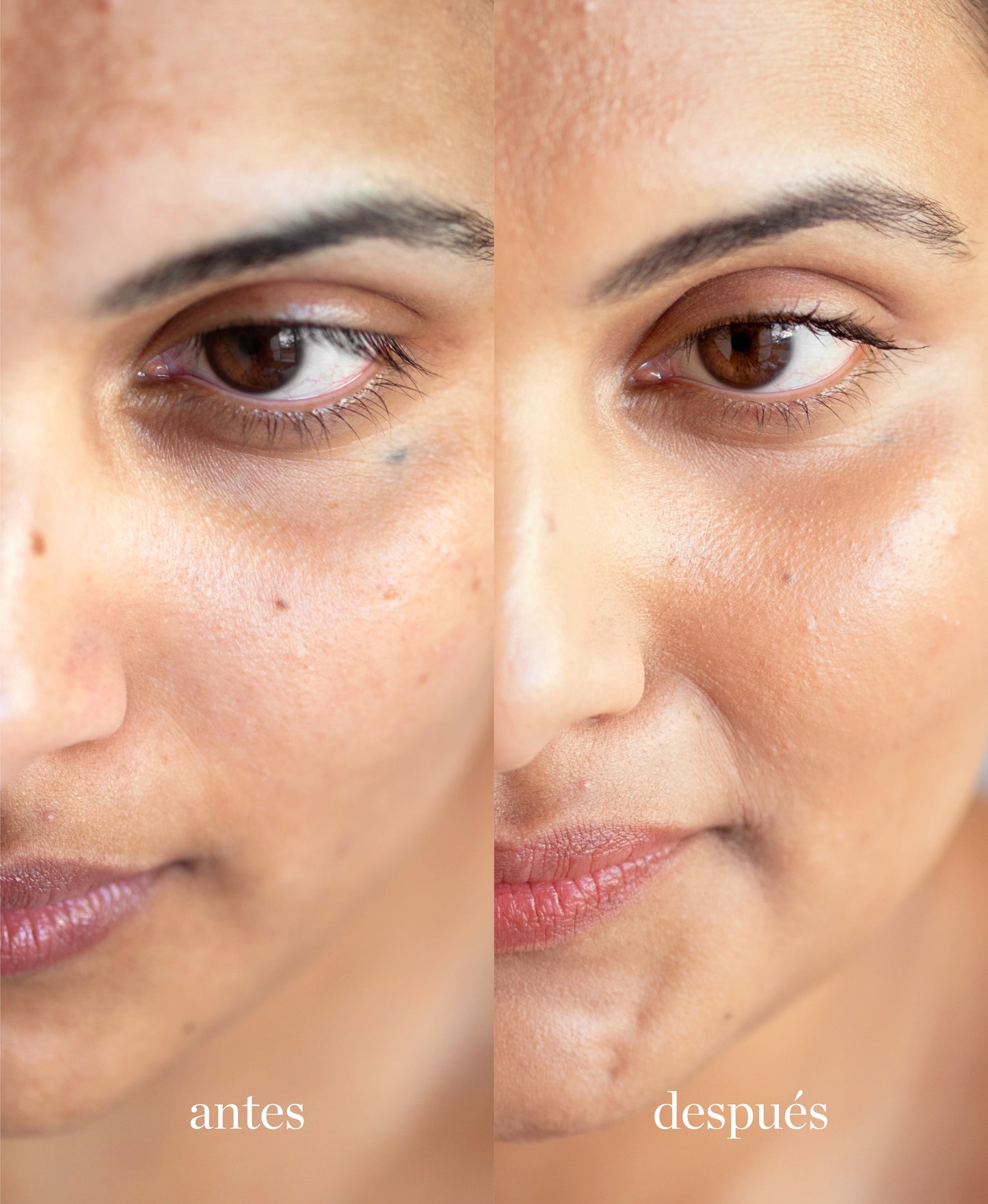 muestra de diferencias antes y despues en mujer de utilizar corrector con lichi ere perez tono cinco