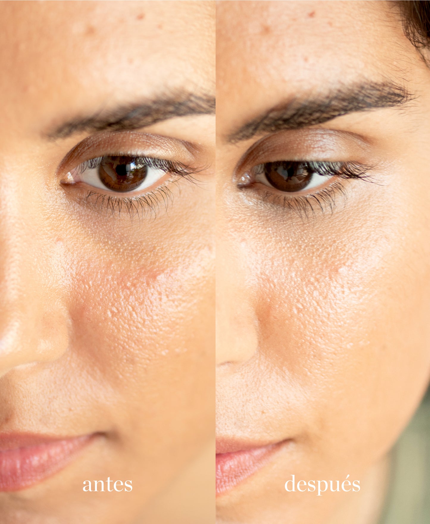 muestra de diferencias antes y despues en mujer de utilizar corrector con lichi ere perez tono cuatro