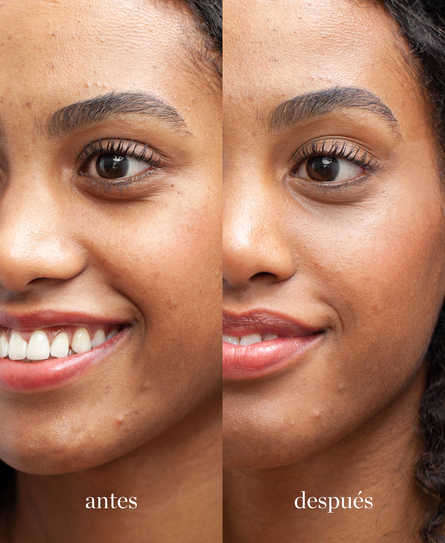 muestra de diferencias antes y despues en mujer de utilizar corrector con lichi ere perez tono seis